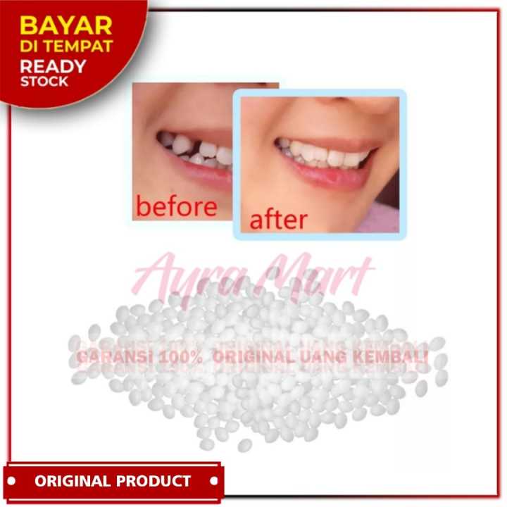 Tambal Gigi Bolong Permanen Original Tambal Gigi Permanen Dokter Penambal Gigi Ompong Permanen Origi