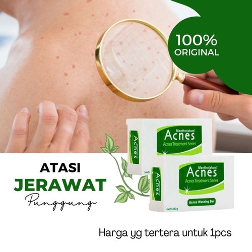 Sabun Padat Jerawat Wajah Dan Punggung Paling Ampuh Sabun Muka Batang Acnes Pembersih Jerawat Anti B