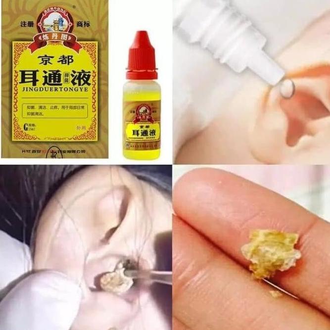 TERBARU Obat Tetes Telinga Herbal Cina untuk Perawatan Tuli Otitis Tinnitus /OBAT TELINGA BERDENGUNG