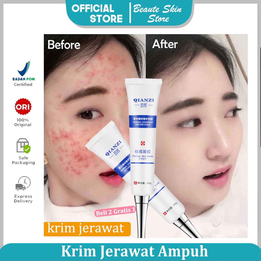 Cream Obat Jerawat Paling Ampuh ​Acne Rejuvenation Cream Jerawat Krim Jerawat Menghilangkan Jerawat Cepat Menghilangkan Jerawat Removal of Acne Cream Untuk Memperbaiki Kulit Denga Krim Penghilang Jerawat dan Bekas Jerawat Pria dan Wanita 30g