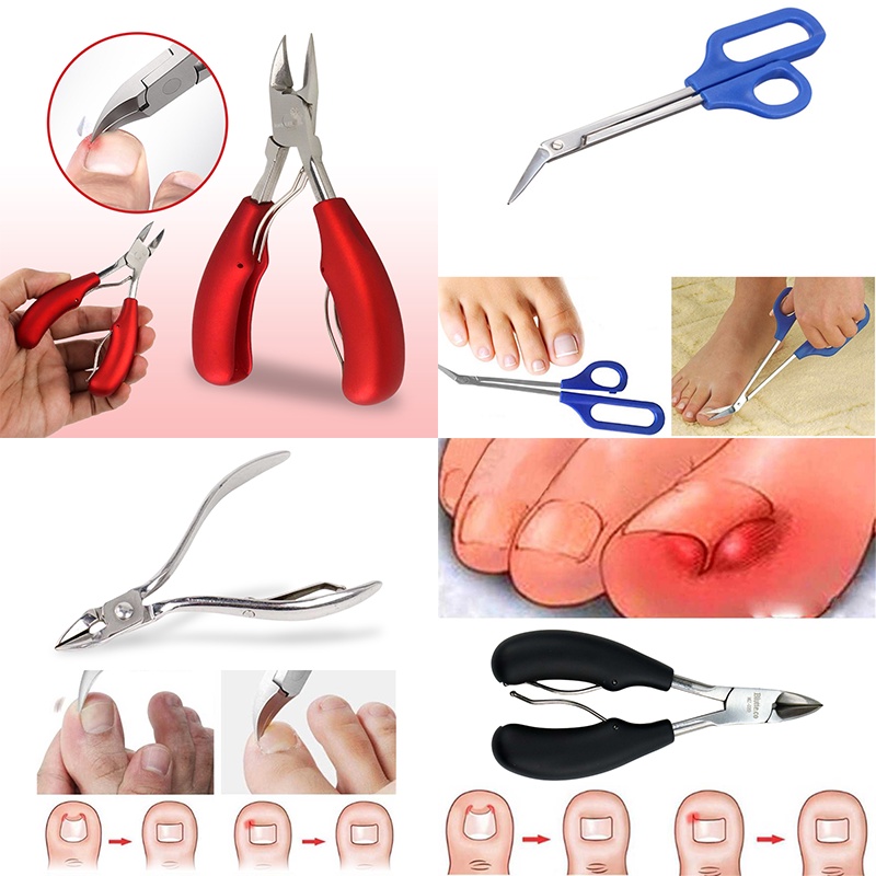 Gunting Kuku Cantengan Dead Skin Dirt Remover