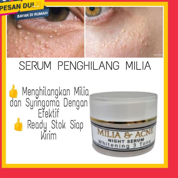 X69J  Penghilang Milia Bintik Bintik Putih dibawah Mata Serum Milia dan Syringoma Cream