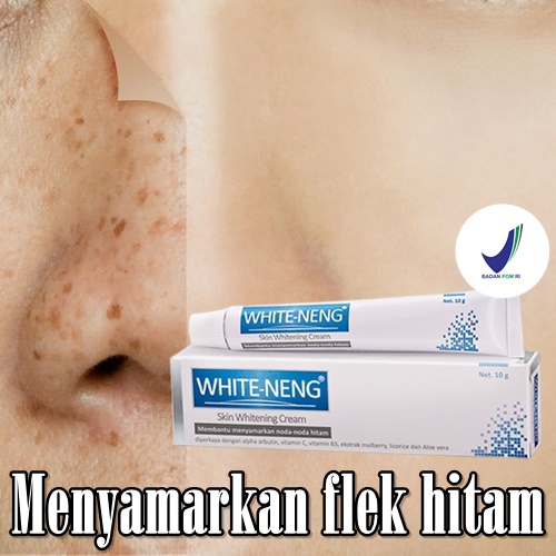 Krim Wajah Penghilang Flek hitam BPOM White Neng skin whitening cream Membantu menyamarkan Flek Hita