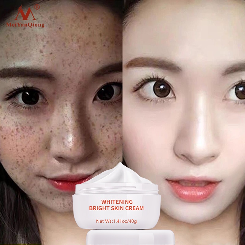 [100% Asli] Cream Skin Care Anti Freckle Whitening Moisturize Cream-cream pemutih-wajah glowing krim cream penghilang flek hitam membandel cream pemutih-wajah glowing pencerah wajah