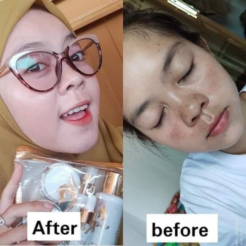 RATU GLOW SKINCARE BPOM/PAKET SKINCARE/PEMUTIH WAJAH GLOWING KRIM PEMUTIH WAJAH AMPUH SKINCARE