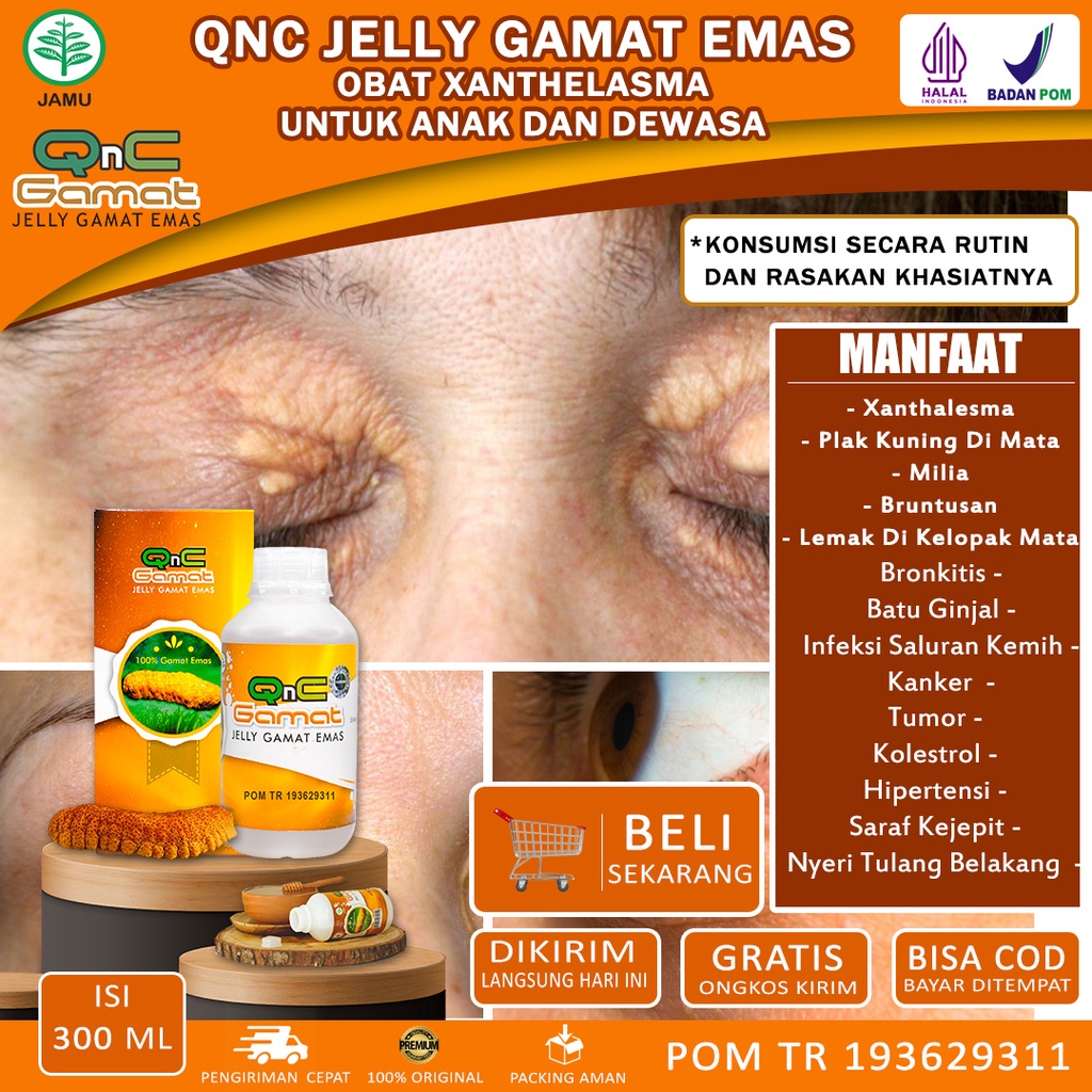 Jual Obat Xanthelasma Penghilang Gumpalan Lemak Di Kelopak Mata Obat