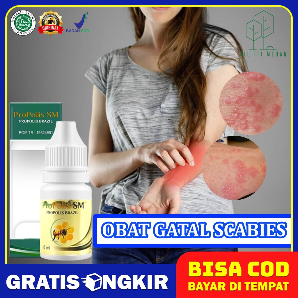 Propolis Anti Gatel Salep Kurap Panu Scabis Original
