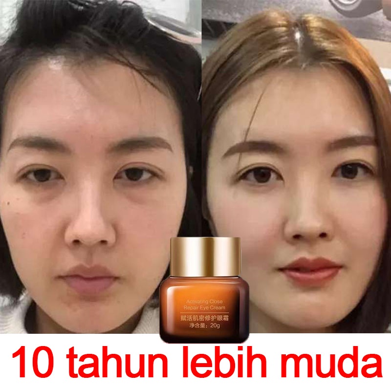 Krim mata treatment mata Eye cream Kecantikan mata Krim mata panda 20g Eye Bag Asam Hyaluronic Activating Close Repair Eye