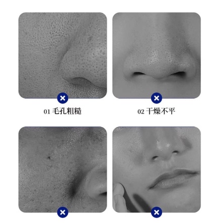 Veze Essence Asam Hyaluronic Caviar Krim Wajah Antikerut Firming Esensi 35ML CJR