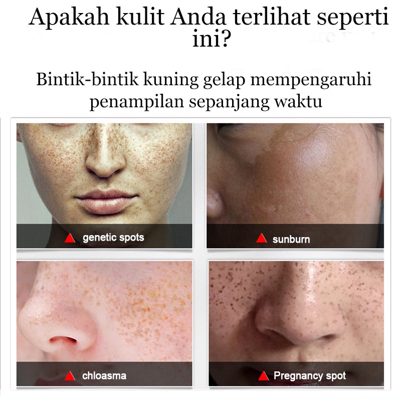 krim Serum cream Flek Hitam Cream Penghilang Cream flek Penghilang 50g Pemutih Asli Dan Penghilang Bintik Memudarkan Bintik Menghilangkan flek Cream penghilang