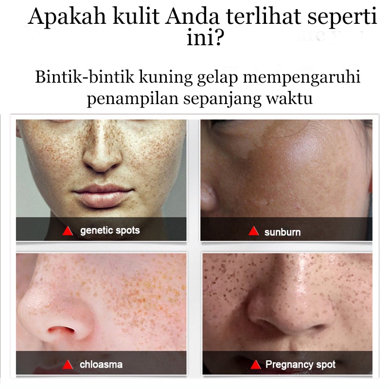 krim Serum cream Flek Hitam Cream Penghilang Cream flek Penghilang 20g Pemutih Asli Dan Penghilang Bintik Memudarkan Bintik Menghilangkan flek Cream penghilang