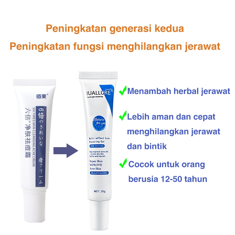cream jerawat obat totol jerawat krim jerawat obat jerawat dan bekas jerawat Jerawat Removal of Acne Cream Untuk Pria dan Wanita Menghilangkan jerawat dengan cepat