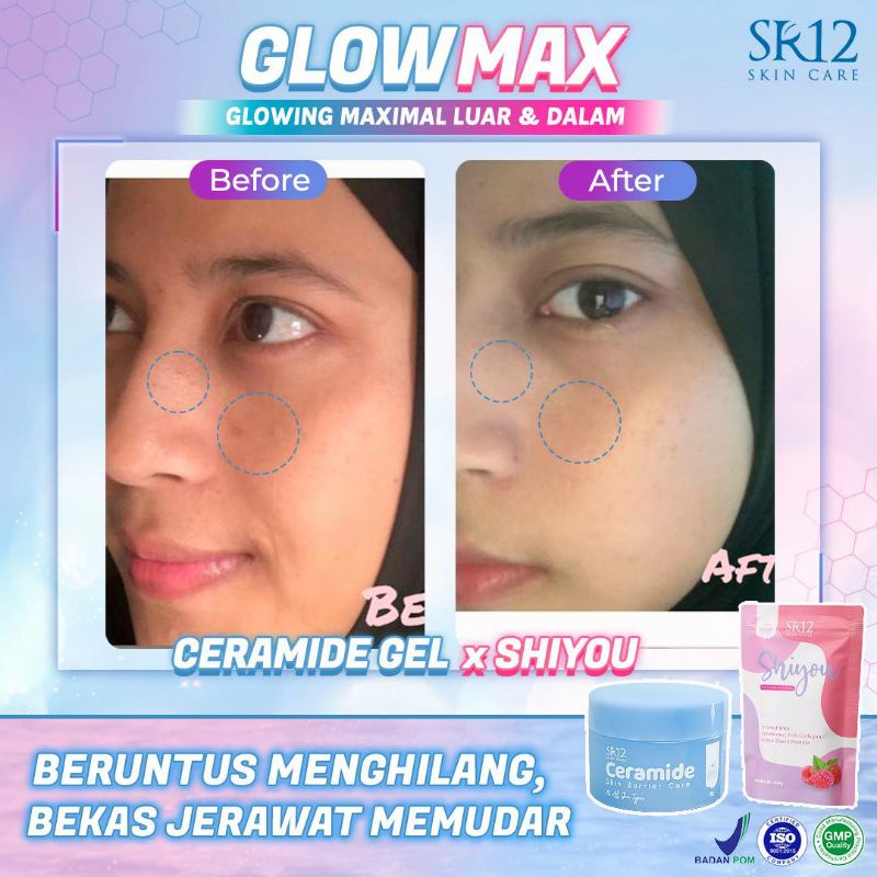 PAKET GLOWMAX SR12 / MINUMAN KOLAGEN SUPLEMEN KECANTIKAN TUBUH / PEMUTIH PENCERAH KULIT WAJAH / GLOWING MAXIMAL LUAR &amp; DALAM / MEMPERBAIKI SKIN BARRIER