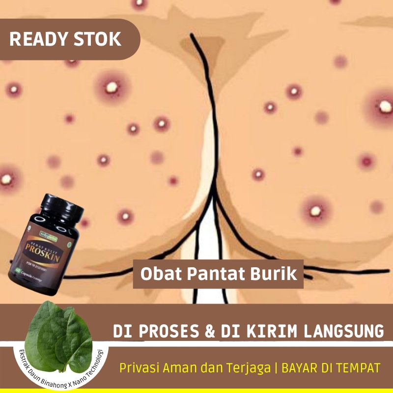 Obat Pantat Burik - Obat Pantat Burik Dan Selangkangan Hitam - Pantat Jerawatan | PROSKIN