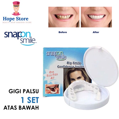 Hope Store - Gigi Palsu Atas Bawah Snap One Smile Silikon 100% ORI 1 Set FREE DUS