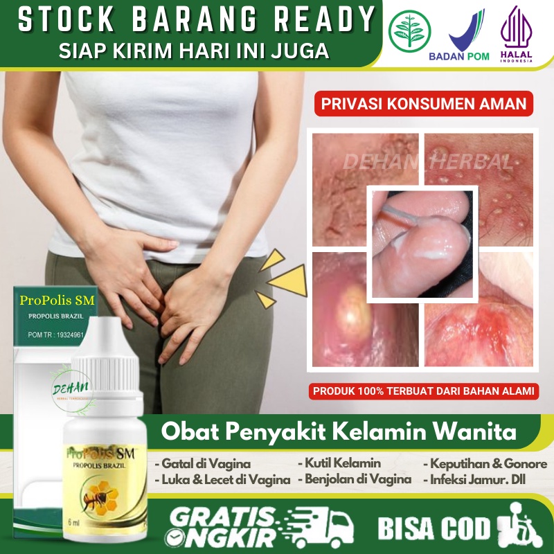 Obat Vagina Gatal & Lecet 100% Asli Alami, Penghilang Vagina Gatal Menahun, Pengering Luka / Lecet d