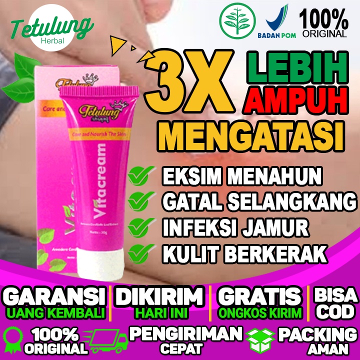 Obat Salep Untuk Gatal Di Selangkangan Obat Salep Untuk Gatal Kurap Obat Salep Untuk Gatal Karena Ja