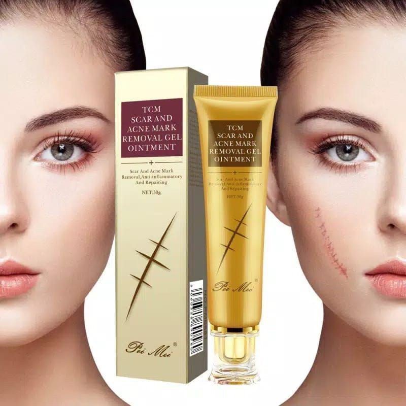 LANBENA TCM SCAR and ACNE REMOVAL gel ointment, PENGHILANG BEKAS LUKA