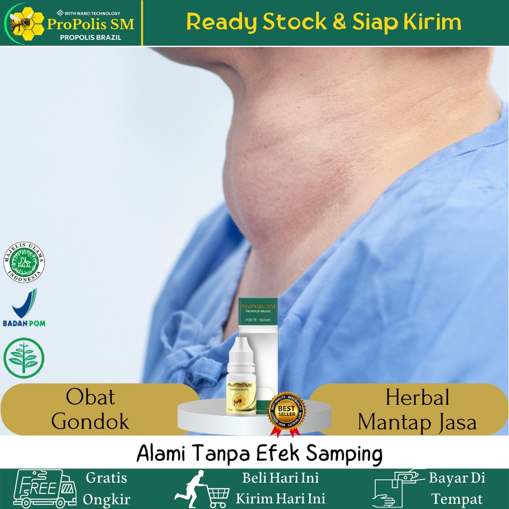 Obat Gondok, Obat Tiroid, Obat Gondok Di Leher, Obat Benjolan Di Leher, Obat Herbal Gondok Tiroid, A