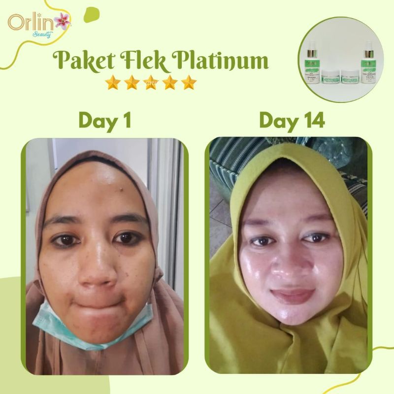 Miffglow - Orlin Beauty paket flek platinum original pemutih obat flek penghilang flek hitam