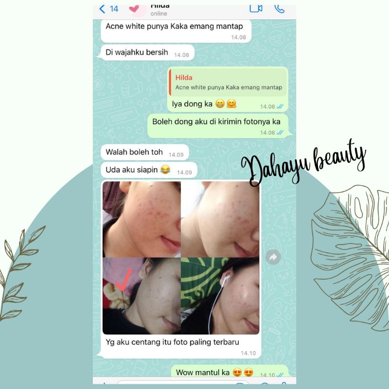 CREAM MALAM ACNE WHITENING 35.000