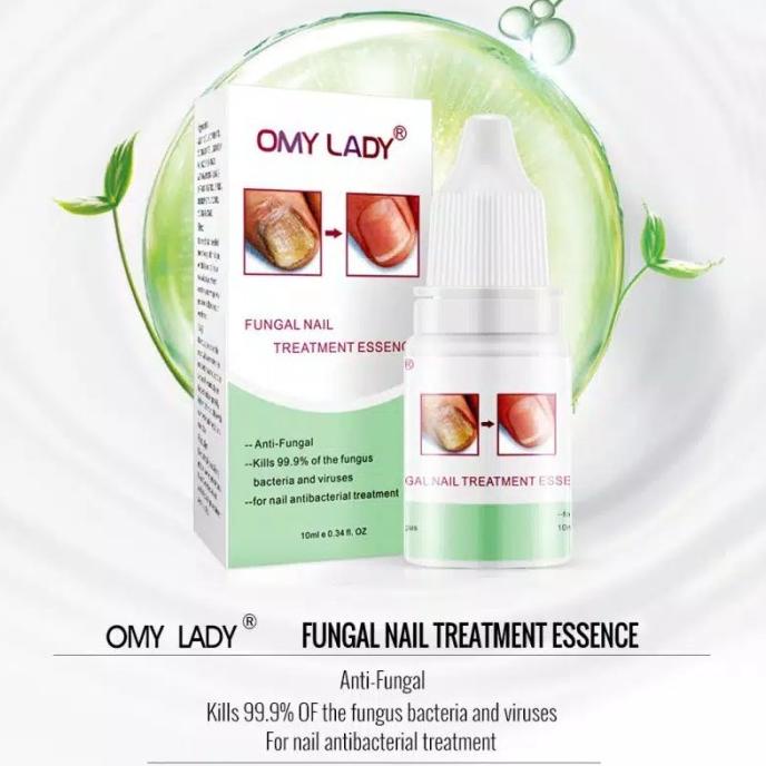 Nail Obat Kuku Cantengan Jamuran Omy Lady