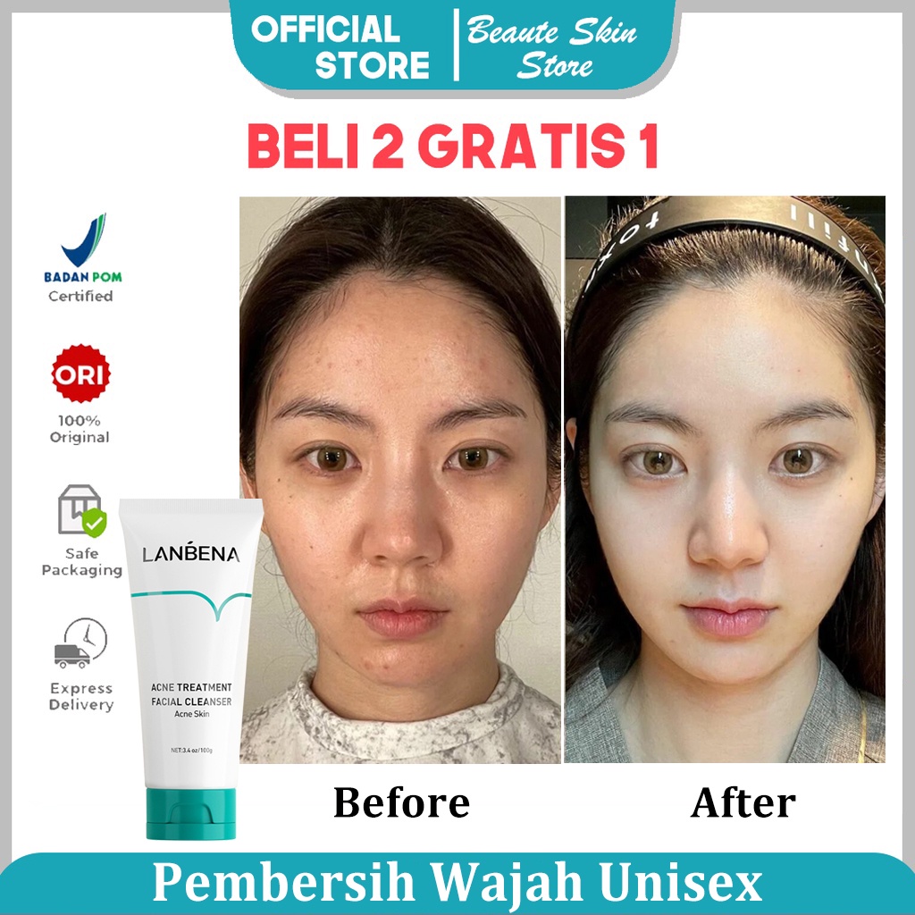 [BPOM] LANBENA Oligopeptide  ponds sabun Jerawat alat Jerawat pembersih wajah  muka make up wajah pria wanita alat pembersih wajah pemutih pembersih muka ponds Oil Control Skin Acne Treatment 100g