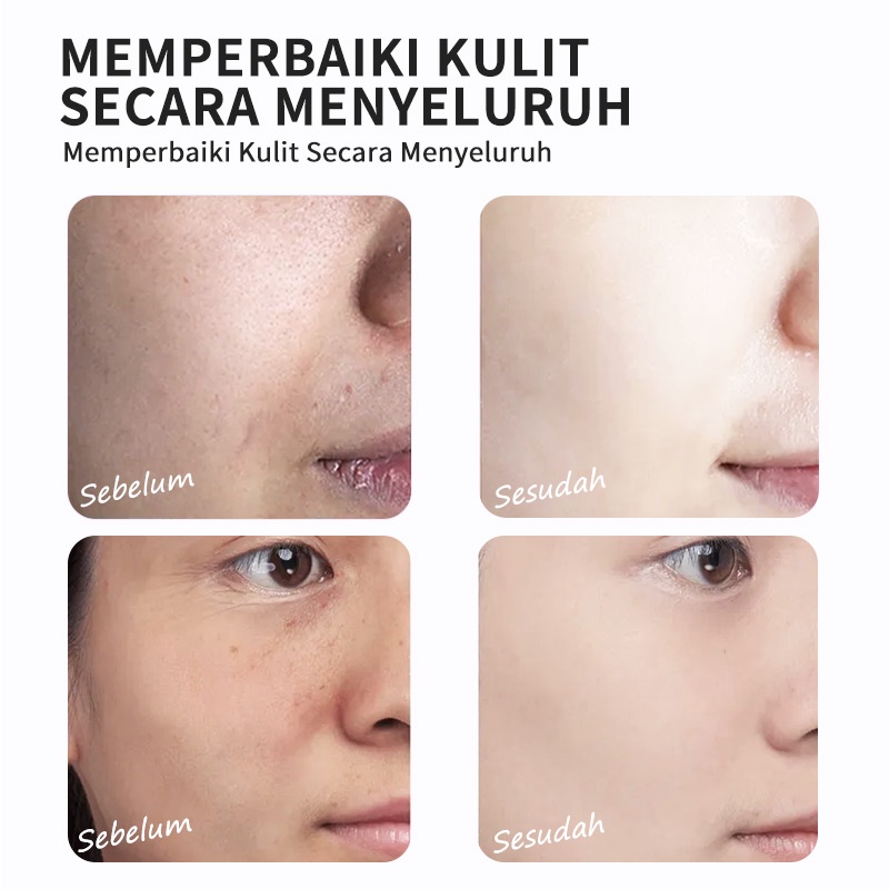 [BPOM]RtopR  Serum Pemutih Vitamin C  Esensi VC Asam Hyaluronic  Pelembab  Hapus Bintik Bintik Memudarkan Bintik Hitam  Siput  Perawatan Kulit Anti-Penuaan 20ml