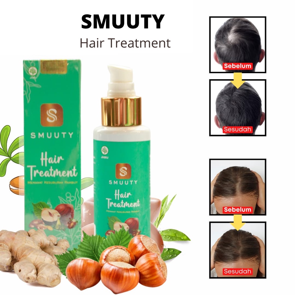 SMUUTY Hair Treatmen - Serum Penumbuh Rambut - Mencegah Kebotakan Pada rambut - Penghilang Ketombe -