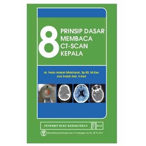 Buku 8 Prinsip Dasar Membaca CT-Scan Kepala - Feda Anisah Makkiyah