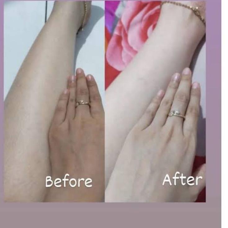 SPECIAL PRICE Glutaskin Yellow dosis 750 mg Lc Beauty Original Bpom Kapsul Pemutih ✩ 861