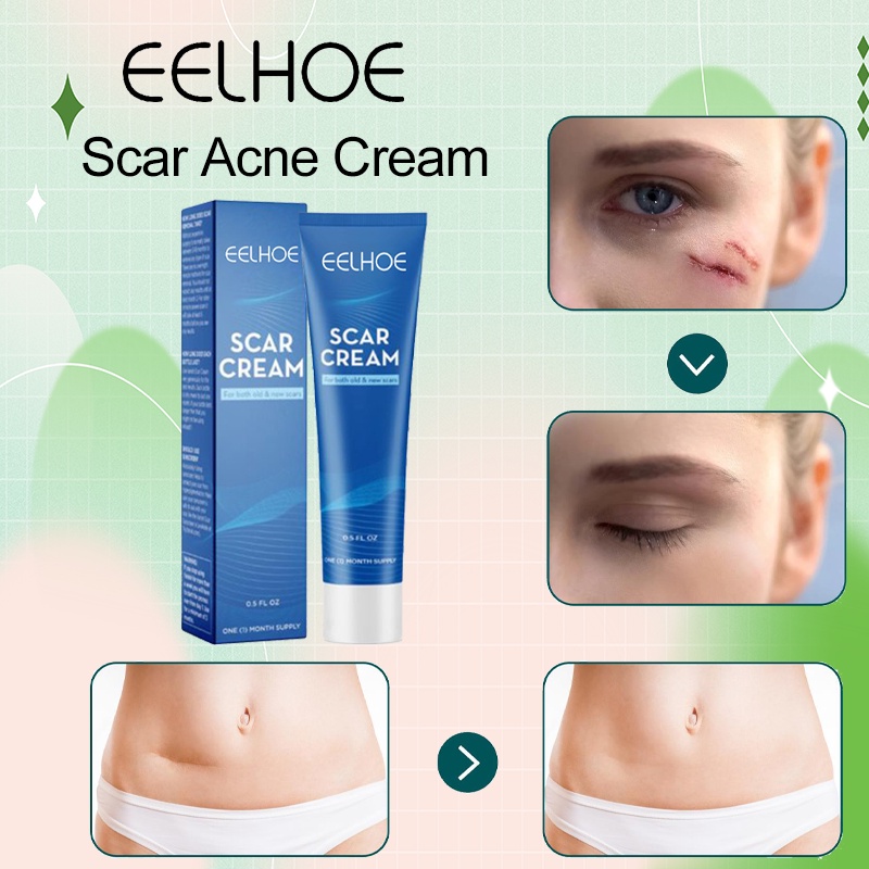 Eelhoe Scar Cream Penghilang Bekas Luka Dan Keloid Scars Cream Removel 30gr Scar Cream Removel