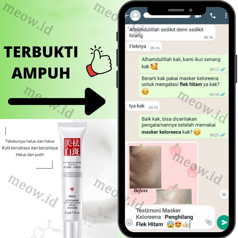 Penghilang flek hitam Night whitening salep flek hitam White neng cream flek hitam penghilang flek hitam di wajah 20g Cream Salep Pemutih Efektif Penghilang Bintik hitam Diwajah Jerawat Dan Bekas Jerawat