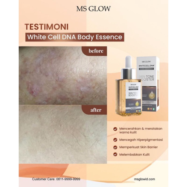 SKIN BOOSTER MS GLOW