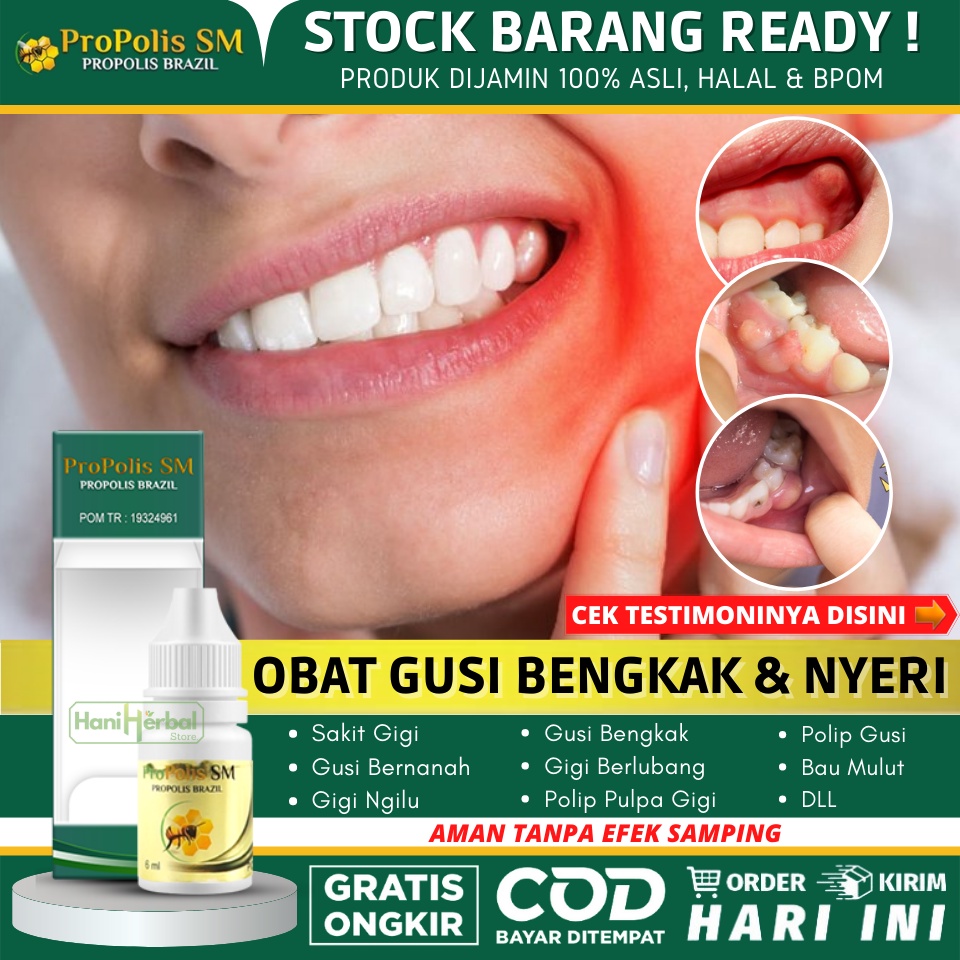 Obat Gusi Bengkak Disertai Nyeri 100% Herbal Alami - Gusi Bernanah, Sakit Gigi, Gigi Berlubang, Gigi