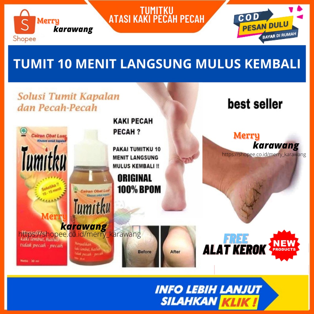 Obat kaki pecah dan kering foot cream ampuh bpom original