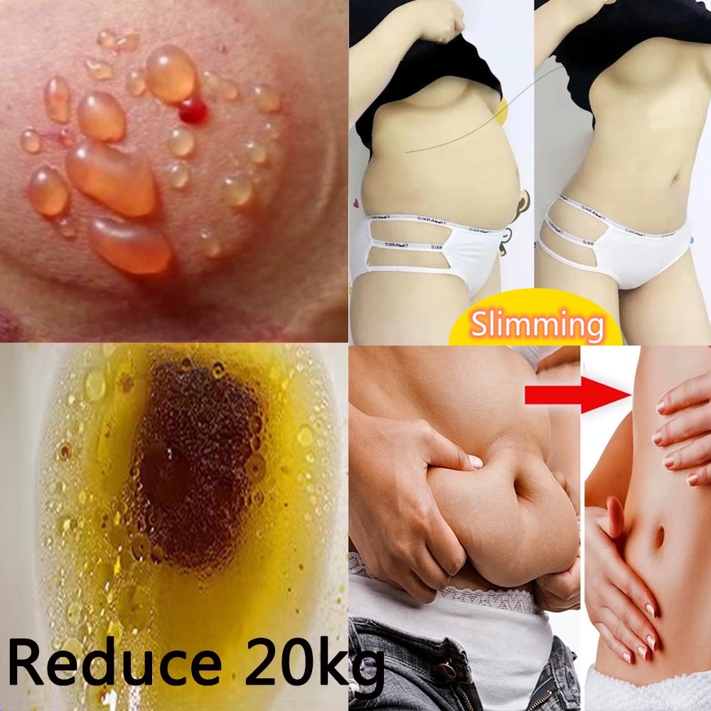 50 PCS Koyo Pelangsing Slim Patch Detox Penurunan Detox Slim Untuk Pelangsing / pembakar lemak stiker pelangsing Pembakar Lemak Produk pelangsing