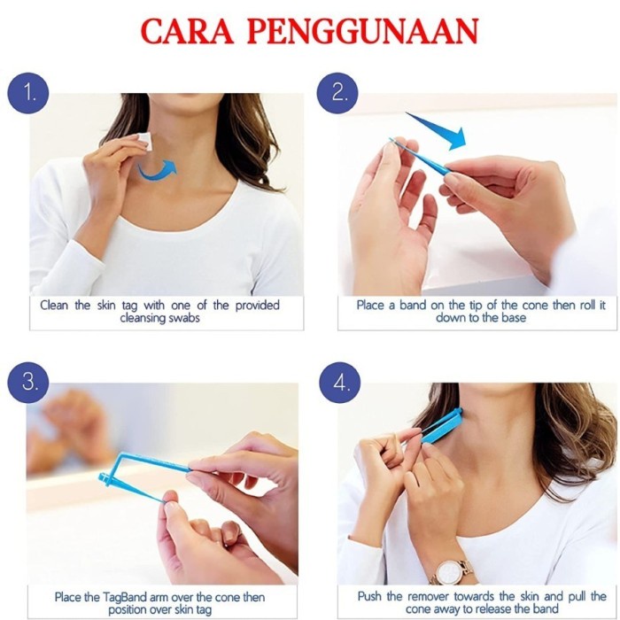 barokah gamis Auto Micro Skin Tag Remover Alat Penghilang Kutil Painless Removal Kit