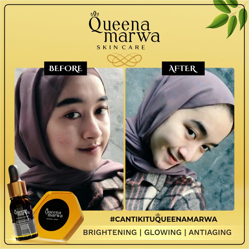 Paket Glowing 1 pcs Face Serum + 1 Box Face Soap Isi 5 Queena Marwa Original Terjangkau