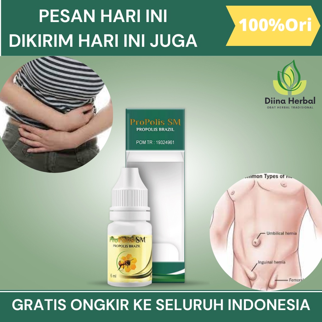 Obat Hernia Turun Berok Dewasa Dan Anak, Obat Hernia Turun Berok, Obat Hernia Inguinalis, Obat Herni