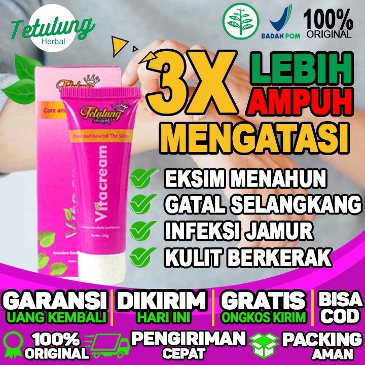 Salep Untuk Gatal Iritasi Salep Untuk Gatal Infeksi Salep Gatal Untuk Ibu Menyusui Salep Untuk Perut