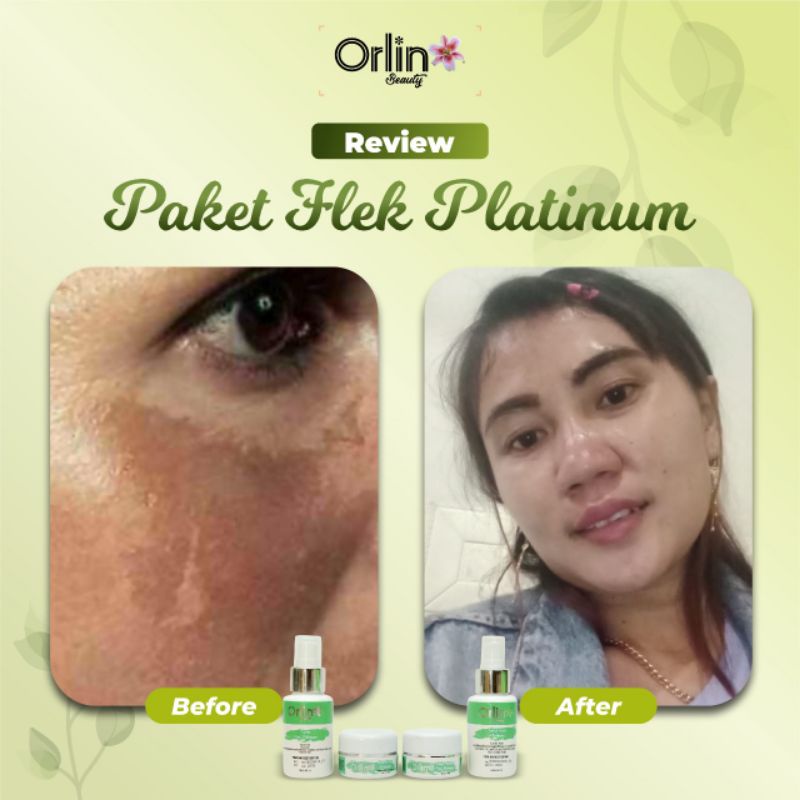 Miffglow - Orlin Beauty paket flek platinum original pemutih obat flek penghilang flek hitam