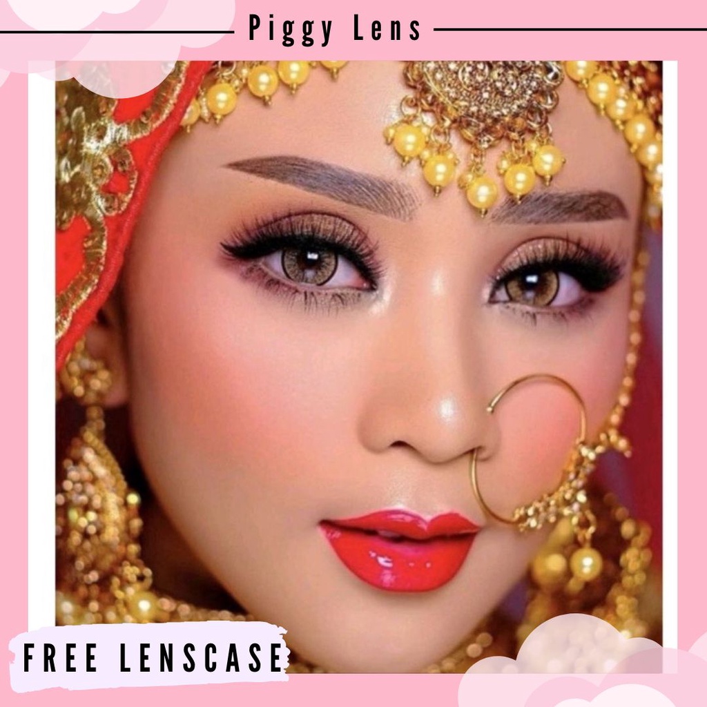 SOFTLENS TOPGEL UNIVERSAL DIA 15MM NORMAL ONLY