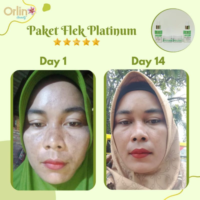 Miffglow - Orlin Beauty paket flek platinum original pemutih obat flek penghilang flek hitam