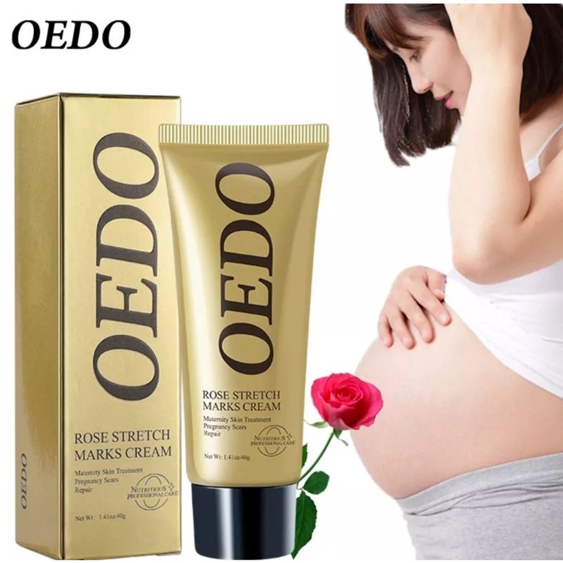 OEDO MAWAR PENGHAPUS STRETCH MARKS KRIM BERSALIN PENGHILANG BEKAS LUKA-40gr