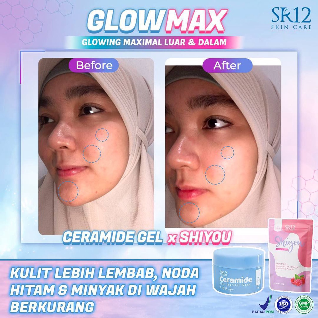 SR12 Ceramide Skin Barrier Care 18gr Pelembab Wajah Melembabkan Mencerahkan Kulit Muka BPOM