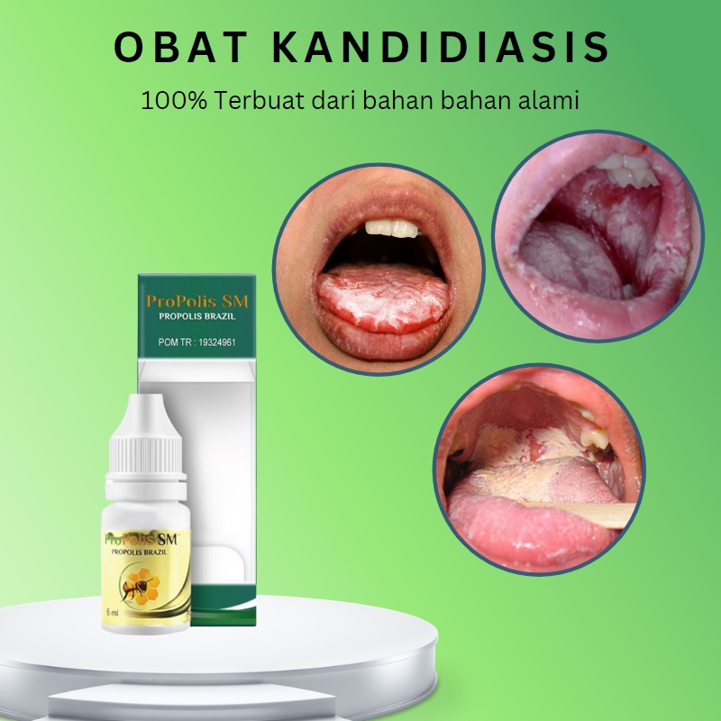 Obat kandidiasis mukokutan, obat pembersih lidah, Obat Lidah Putih Terasa Pahit, Obat Kandidiasis Mu