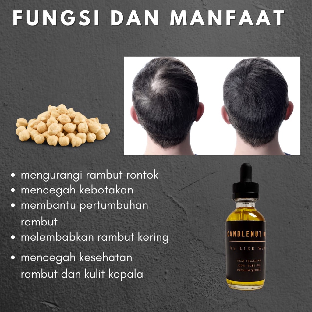 MINYAK KEMIRI - PENUMBUH RAMBUT - PENUMBUH RAMBUT BOTAK - PENEBAL RAMBUT - PENUMBUH BREWOK