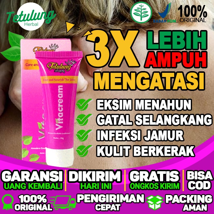 Salep Untuk Gatal Karena Kutu Kasur Salep Untuk Kaki Gatal Salep Untuk Luka Gatal Bernanah