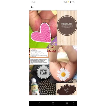 VCO SR12 ORIGINAL BEST SELLER UNTUK BAYI RUAM POPOK / VCO SR12 BPOM / VCO RAMAH UNTUK BAYI / VCO IMU